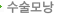 수술모낭